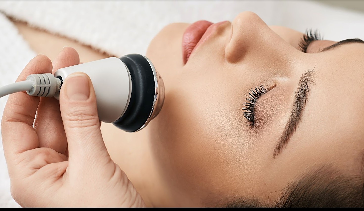 RF Skin Tightening Treatment